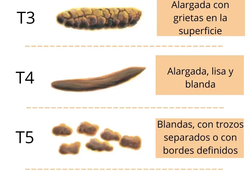 Salud Según la Caca: ¿Qué Dice Tu Caca Sobre Ti?