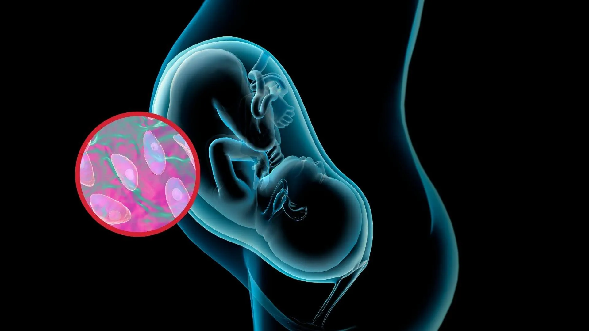 Toxoplasmosis Congénita Riesgos y Prevención en Embarazos — free download