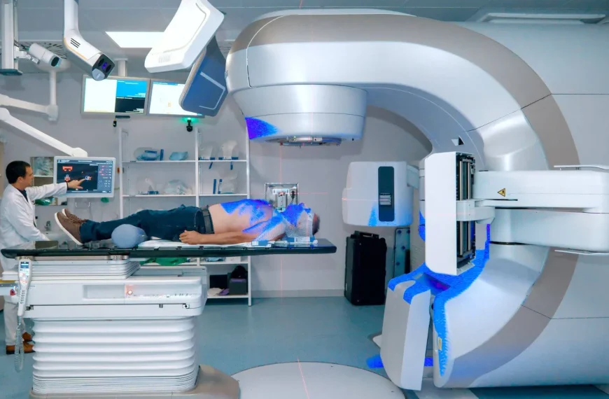 Radioterapia SBRT: Tratamiento Eficaz para Tumores
